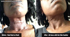 before and after