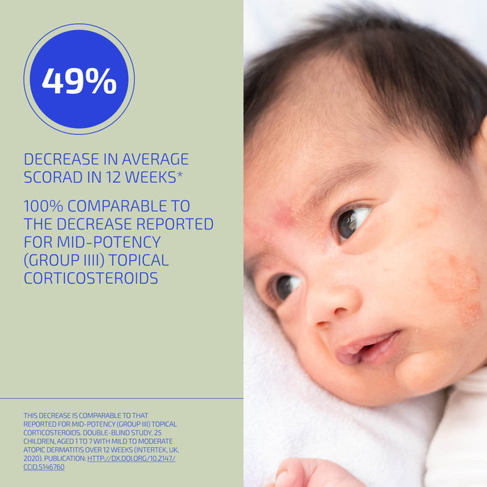 Baby with skin condition next to text about a 49% decrease in average scorad in 12 weeks.