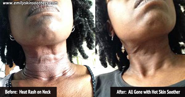 before and after
