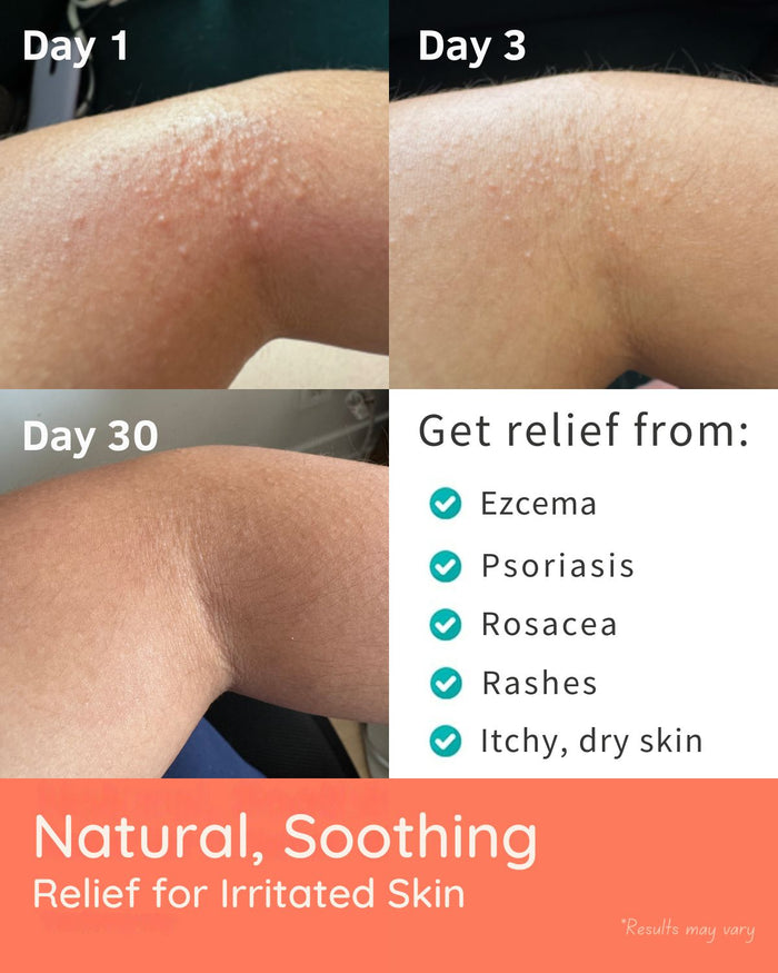 YoRo Naturals Nourish + Hydrate Everyday Routine: 2 Steps
